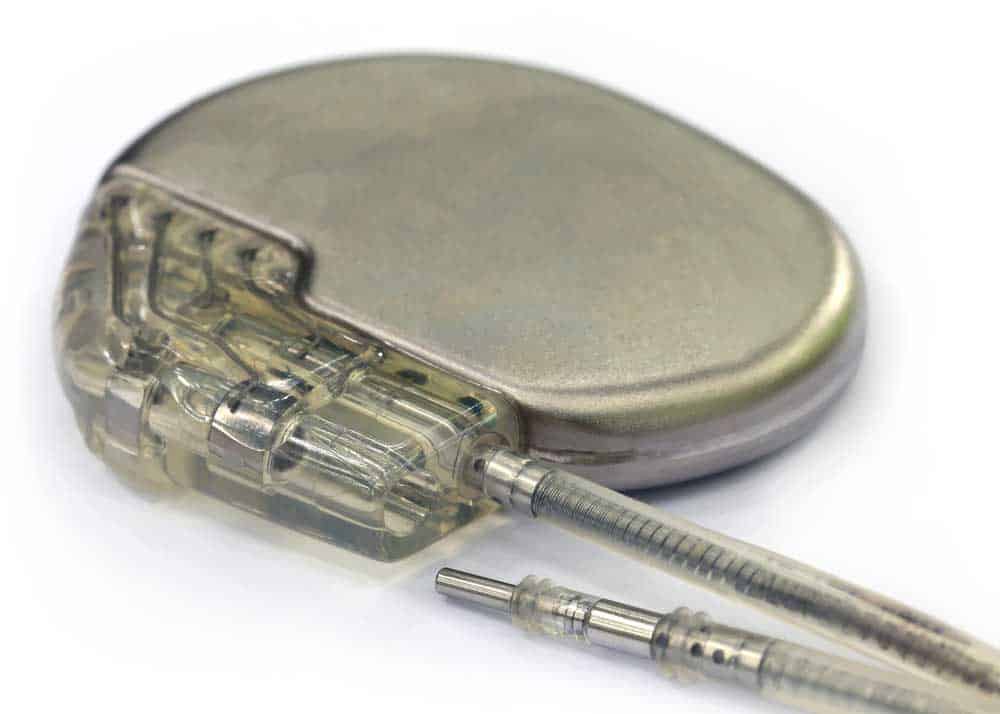 A pacemaker that uses flexible PCBs